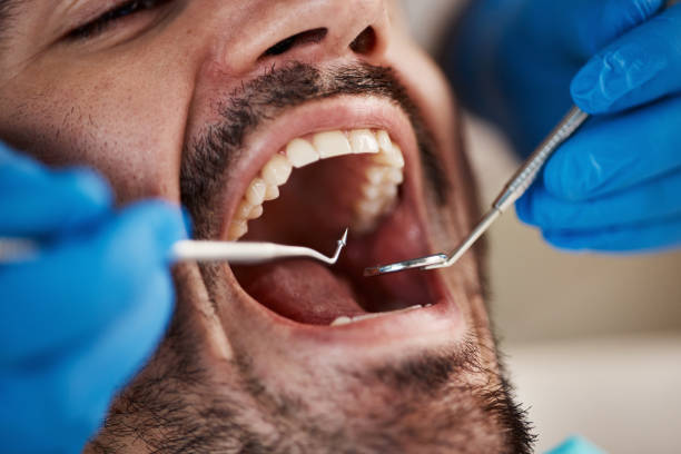 Best Tooth Pain Emergency Relief  in Fairfield, TX
