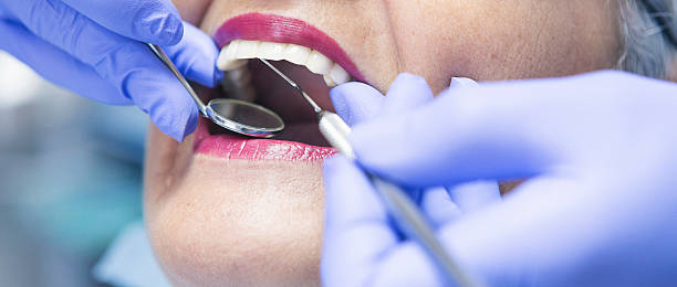 Best Dentist for Tooth Abscess  in Fairfield, TX